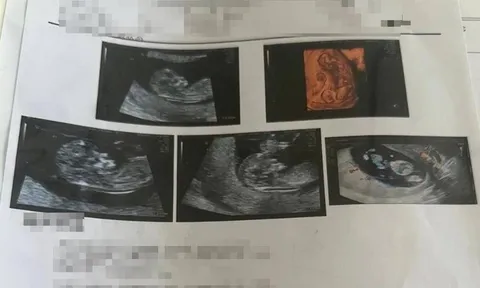 Đi khám thai, người phụ nữ sốc nặng sau khi thấy kết quả siêu âm