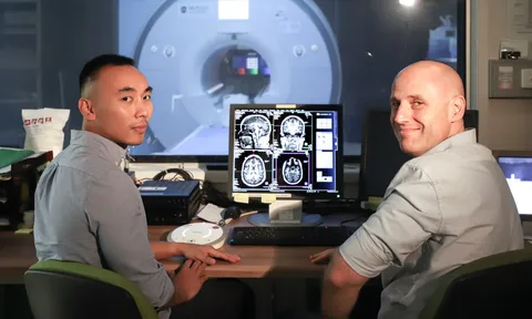 Nghiên cứu đột phá về vai trò quan trọng của hình dạng não bộ