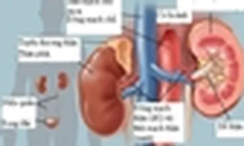 Đừng đối xử 'tệ' với thận!