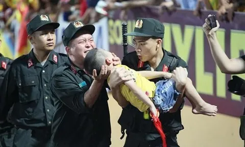 Đại úy CSCĐ cắn răng để bé trai cắn tay ở Nam Định nói gì về việc làm của mình