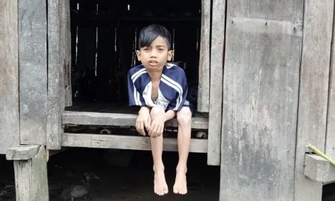 Nỗi buồn của cậu bé lưng gù 90 độ