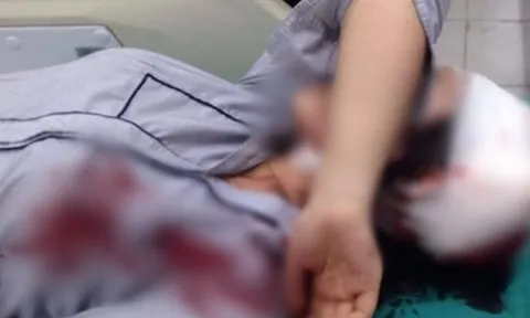 Nữ sinh lớp 10 bị đánh gục trên đường đi học về