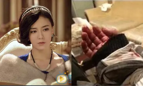 Sao nữ 'Tiếu ngạo giang hồ' cứa cổ tay tự sát vì quy tắc ngầm showbiz?